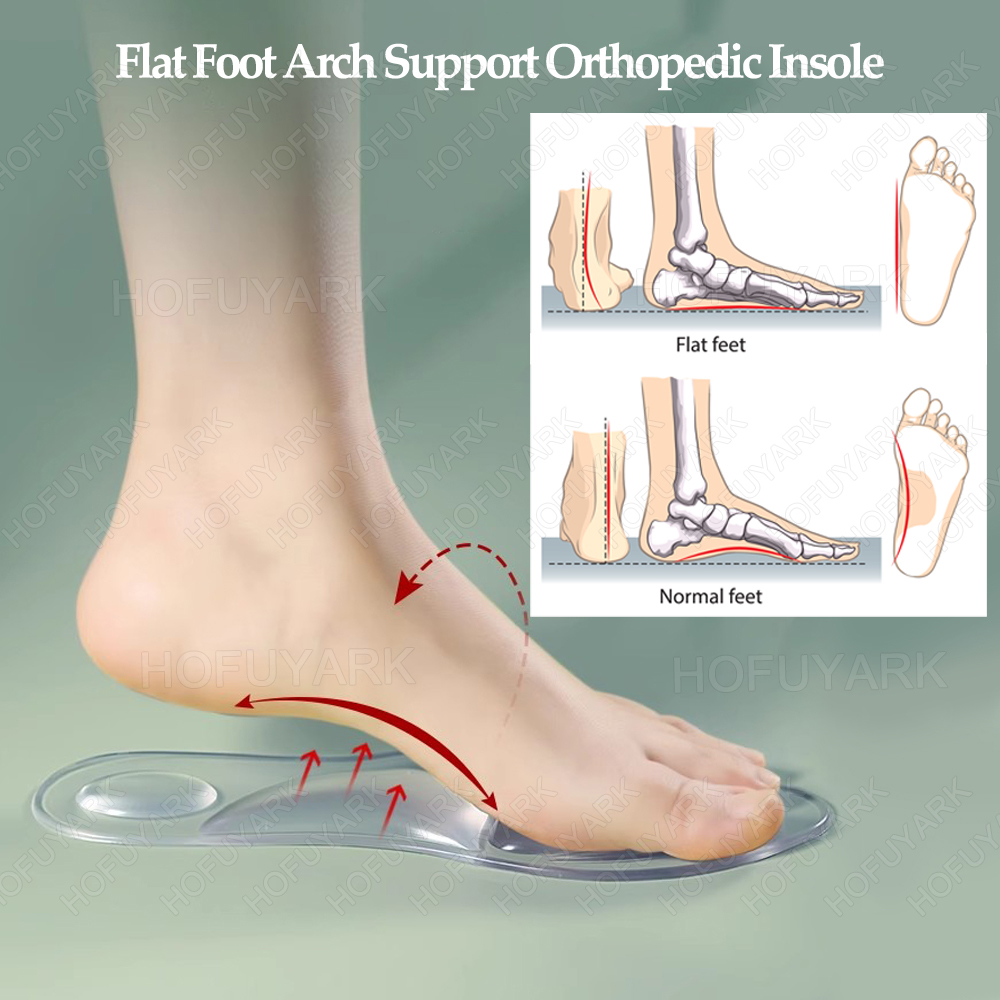 سيليكون هلام النعال العظام شقة - مراجعة Women'S Shoes For Plantar Fasciitis وسعره